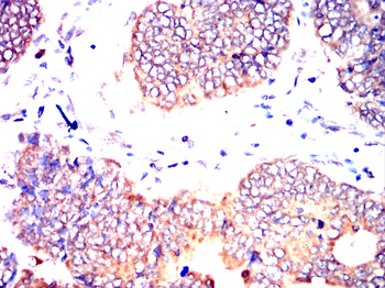 RAB29 Antibody