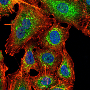LIMK1 Antibody
