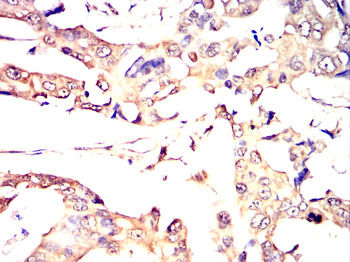 LIMK1 Antibody