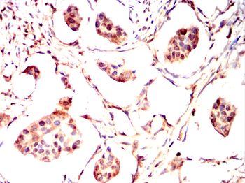 LIMK1 Antibody