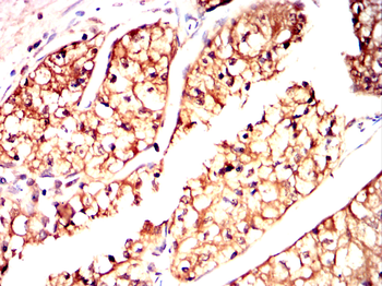 LIMK1 Antibody
