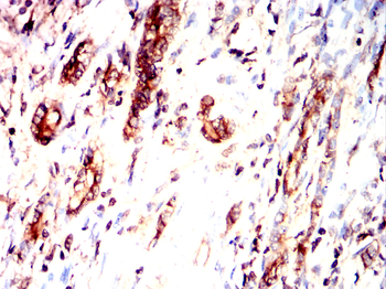 MIPEP Antibody
