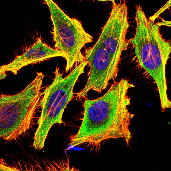 RAB5B Antibody