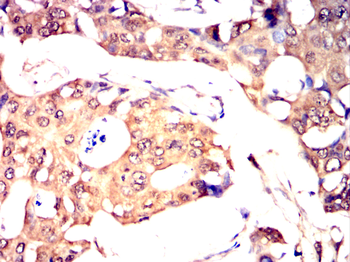 RAB5B Antibody