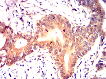 RAB5B Antibody