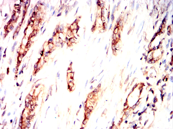 RAB5B Antibody