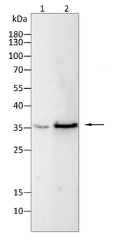 RAB5B Antibody