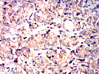 TSC1 Antibody