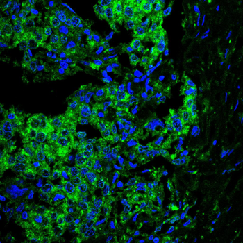 THOC1 Antibody