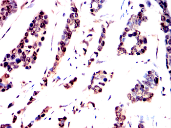 THOC1 Antibody