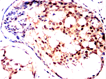 THOC1 Antibody