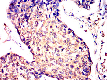 THOC1 Antibody