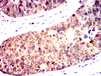 THOC1 Antibody