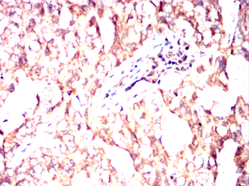 GDF11 Antibody