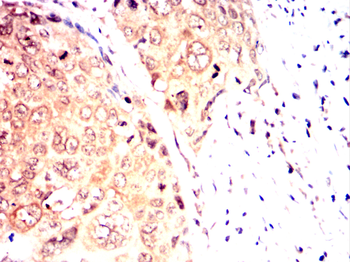 GDF11 Antibody