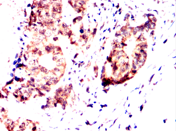 GDF11 Antibody