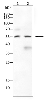 GDF11 Antibody