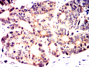 TPX2 Antibody