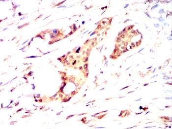 STK39 Antibody