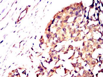 STK39 Antibody