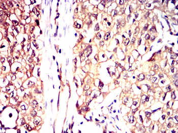 STK39 Antibody