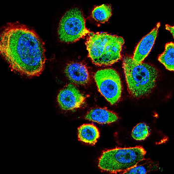 CAB39 Antibody