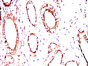 RPS6KL1 Antibody