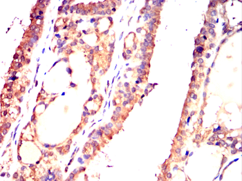 RPS6KL1 Antibody