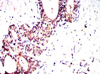 STRA8 Antibody