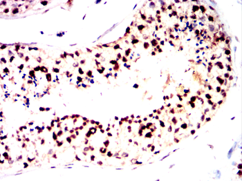 STRA8 Antibody