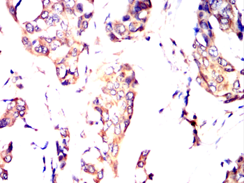 SOCS3 Antibody