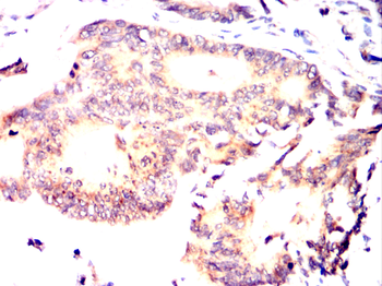 SOCS3 Antibody