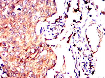 SOCS3 Antibody