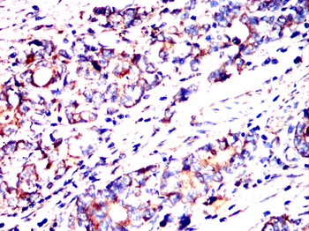 SOCS3 Antibody