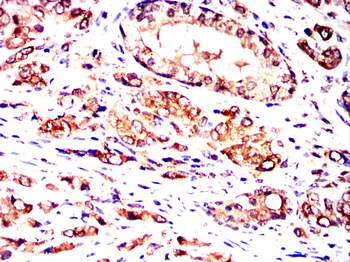 P4HB Antibody