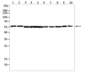 P4HB Antibody