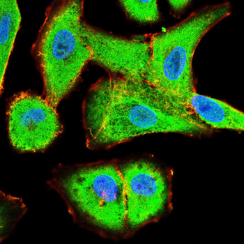 AKAP13 Antibody