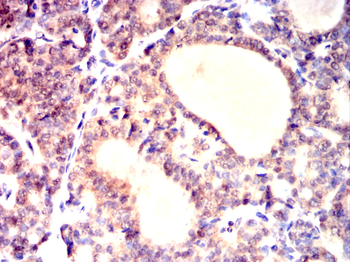 AKAP13 Antibody