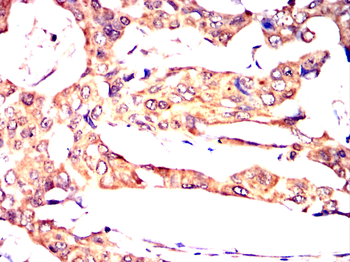 AKAP13 Antibody
