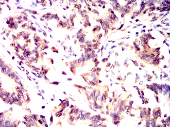 AKAP13 Antibody