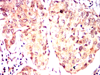 AKAP13 Antibody