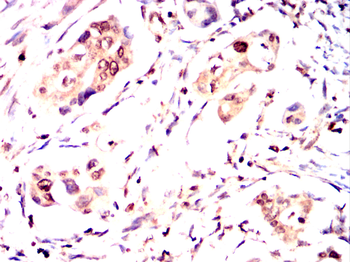 AKAP13 Antibody