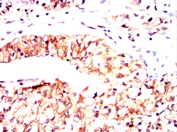 AKAP13 Antibody