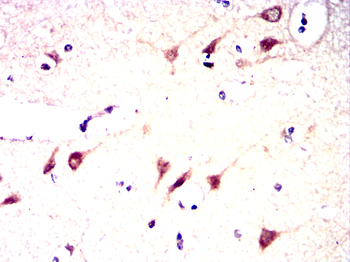 RUVBL1 Antibody