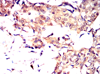 RUVBL1 Antibody