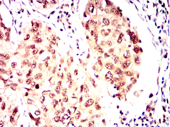 RUVBL1 Antibody