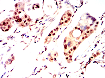 RUVBL1 Antibody