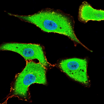 CD4 Antibody