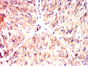 NEDD9 Antibody
