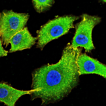 IL6R Antibody